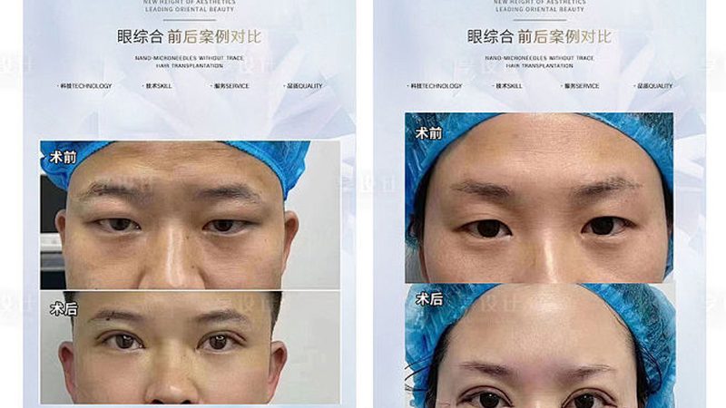 轻医美抗衰项目适合多大年龄