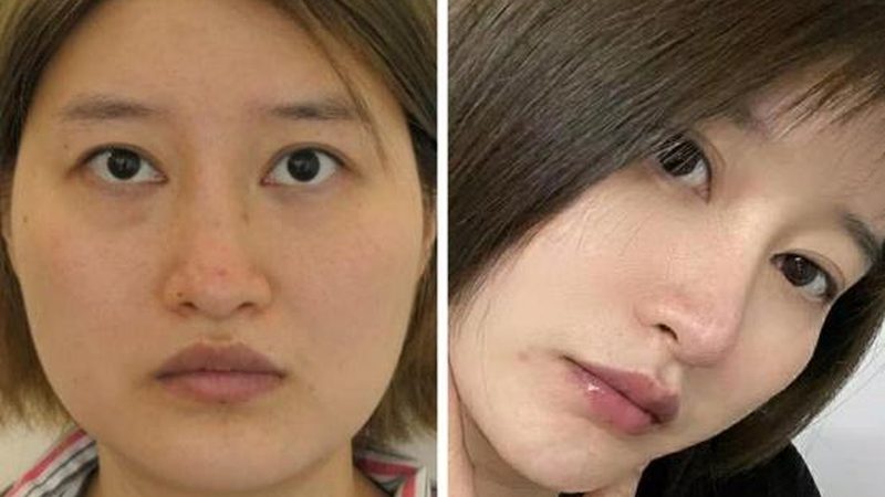 成都医美价格解析：公立医院与私立机构的对比分析