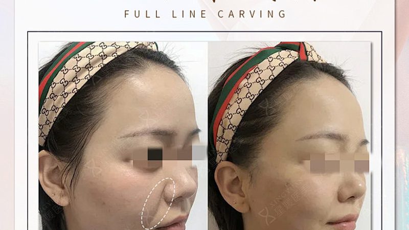 家用美容仪和医美区别对比