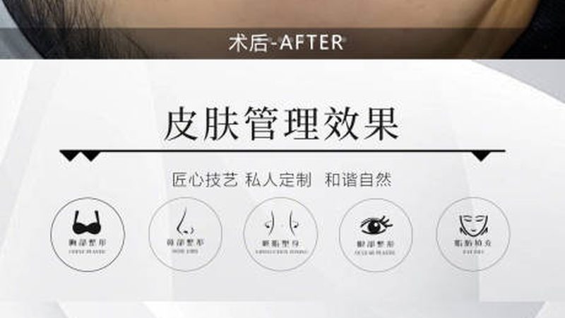 瘦脸绷带真的有效？揭秘其原理与选购要点