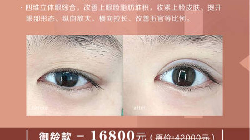 注射美容：揭秘禁忌症与适应症**