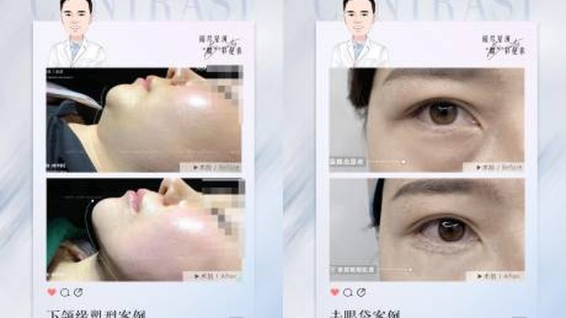 小标题：皮肤美容方案定制，从了解自身需求开始