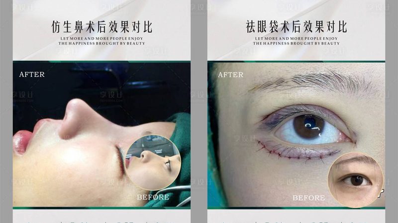 热玛吉美容仪家用和医用区别对比