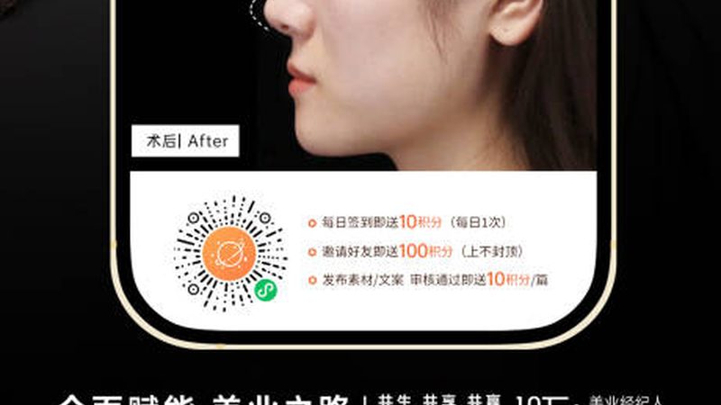 成都全切双眼皮手术：揭秘手术原理与注意事项