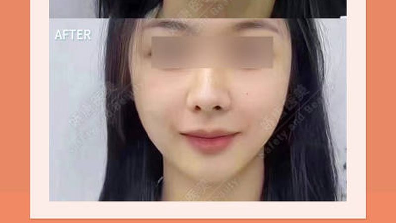 家用瘦脸按摩仪，揭秘其原理与选购要点