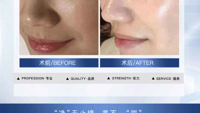 小标题：维生素C与E的作用