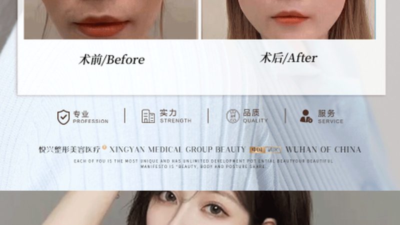 医美咨询师面试自我介绍内容