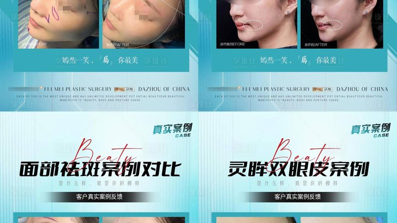 埋线提升法令纹，了解这些副作用才能安心变美