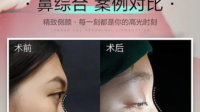 皮肤管理仪器厂家直销批发