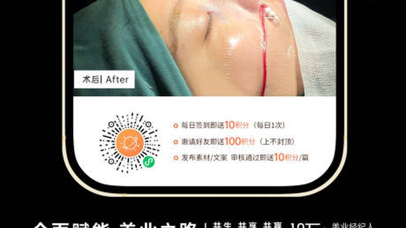 2025年隆鼻价格揭秘：揭秘影响价格的关键因素