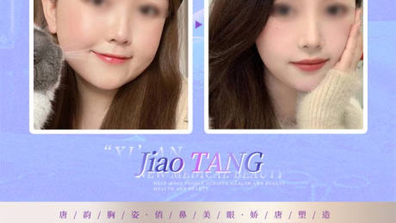 玻尿酸注射后注意事项区别