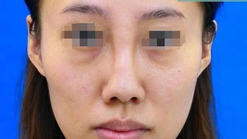 广州皮肤美容诊所收费标准揭秘：看懂这些，才能明智消费